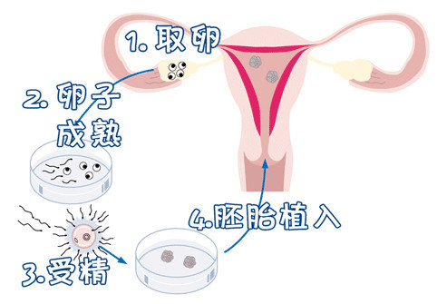 院长